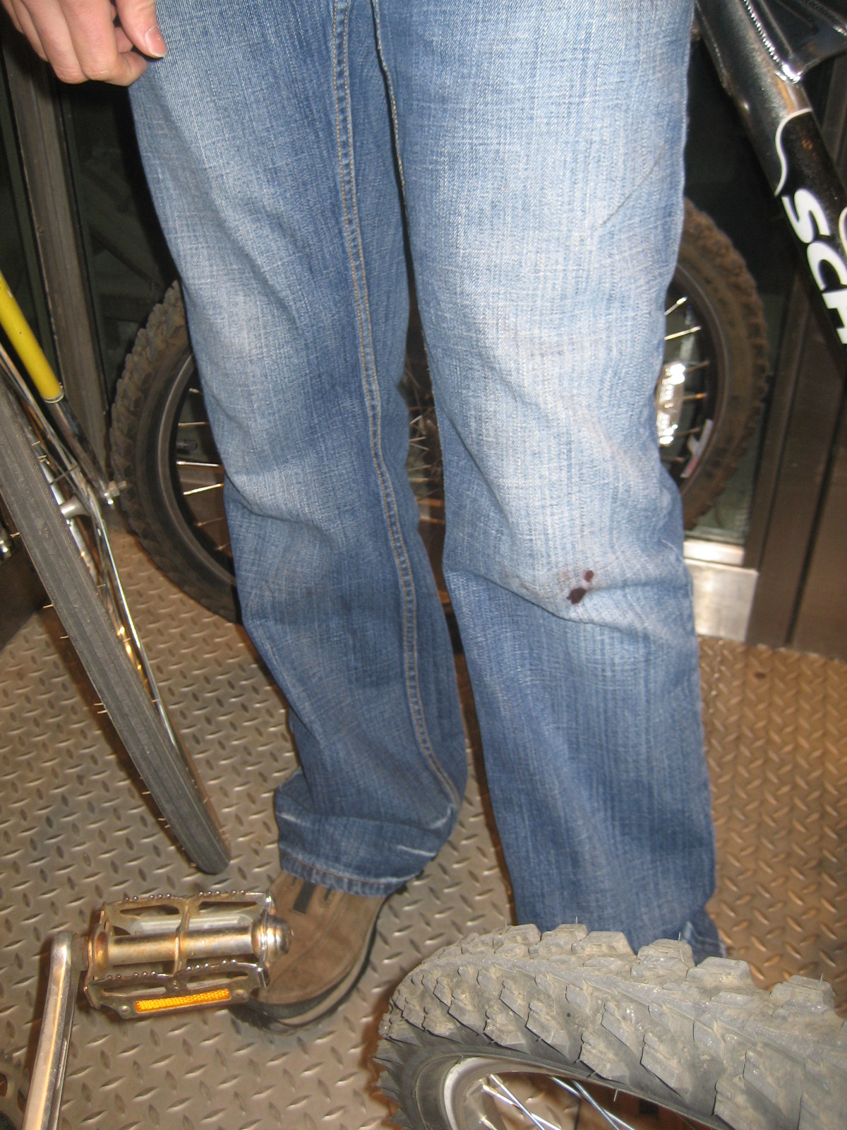 seanie_ripped_knee after skatepark