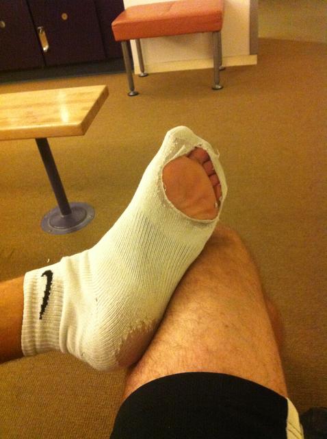 hole_in_sock